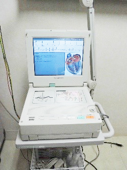 解析機能付最新型心電計